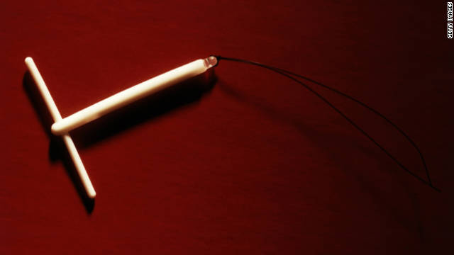 Study IUD's lower cervical cancer risk