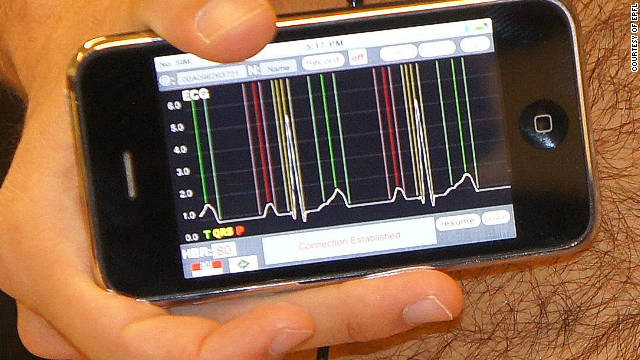 Un "gadget" para tu teléfono detecta anomalías cardiacas y avisa al médico