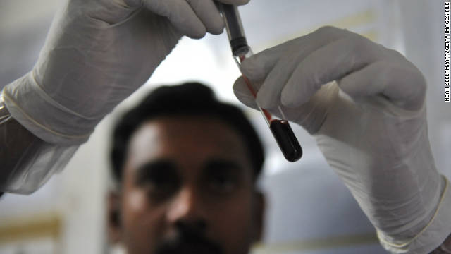 Doctors urge HIV testing starting at 16
