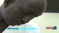 Cancer treatment in Senegal