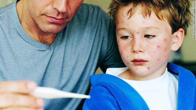 Algunos padres en EE.UU. "enferman" a sus hijos para evitar vacunarlos