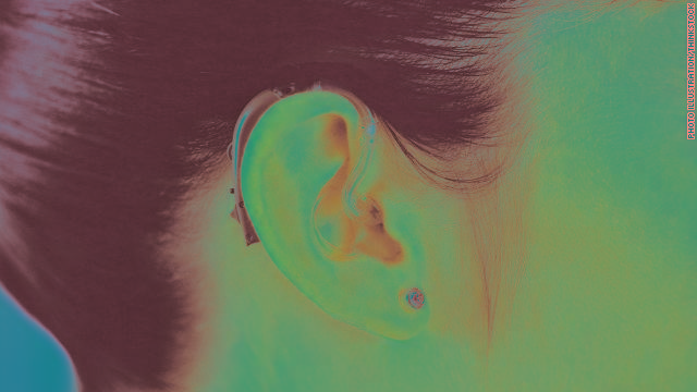 Hearing loss may push decline in memory, thinking