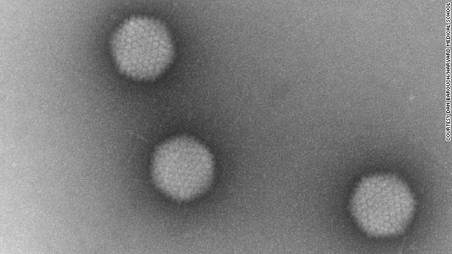 Experimental vaccine helps protect monkeys against AIDS-like infection
