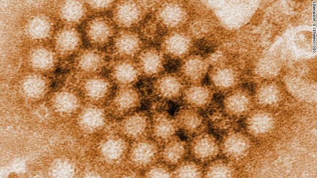 Norovirus found on Washington college campus