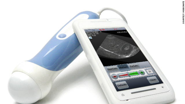 But it's not the only phone tapping into the health market. The Mobisante MobiUS SP1 smartphone ultrasound system has the potential to bring ultrasound technology to remote rural areas.