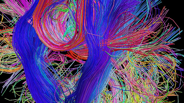 The Human Connectome Project is giving neuroscientists a new perspective on the connections in the brain and how they communicate with each other.<br/><br/>Copyright Laboratory of Neuro Imaging, UCLA and Randy Buckner, PhD. Martinos Center for Biomedical Imaging, MGH. <a href='http://www.humanconnectomeproject.org/' target='_blank'>www.humanconnectomeproject.org</a><br/><br/>