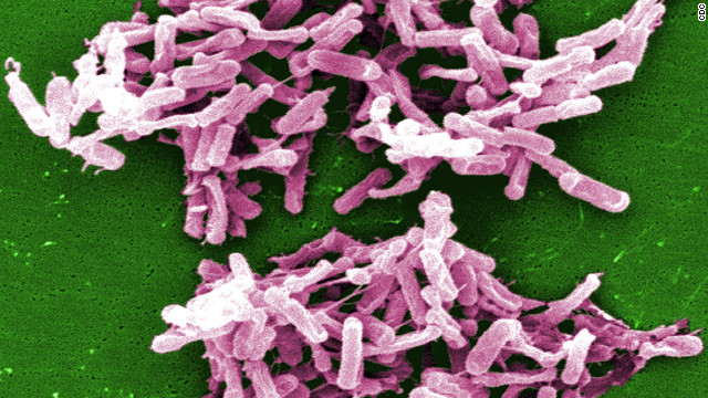CDC: Deadly and preventable C. difficile infections at all-time high