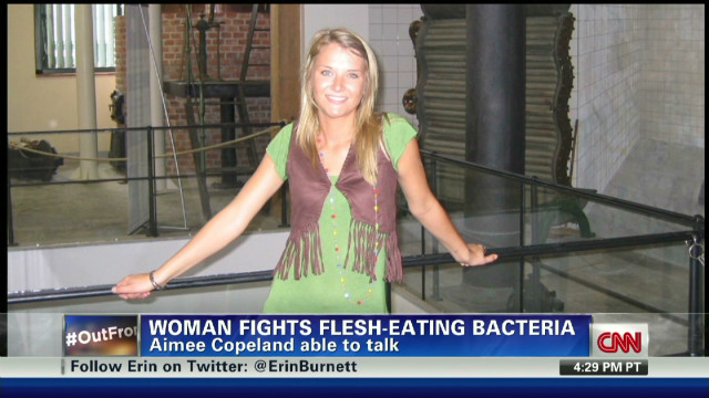 Front Lines Woman Fighting Flesh Eating Bacteria Utters First Words