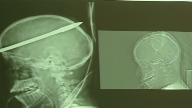 Gotta Watch: Impaled and alive