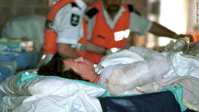 A badly injured victim of the Bali bomb blast arrives at Darwin Hospital on October 14, 2002, for urgently required medical attention after being airlifted from Denpasar. Hundreds of people were injured in the multiple blasts.