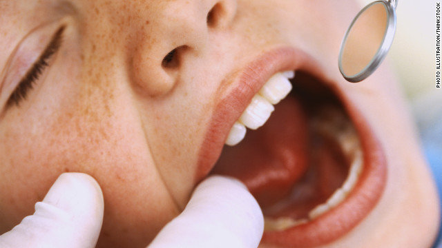 Dental fillings linked to kids' behavior problems