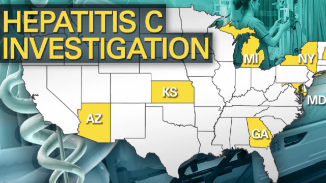 Un brote de hepatitis C causado por un técnico médico alerta a EE.UU.
