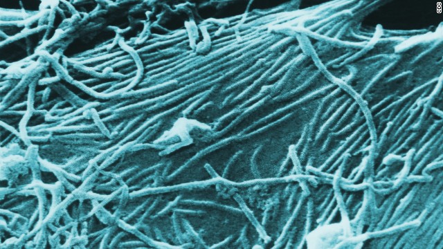 El brote de ébola ¿podría llegar a Estados Unidos y otros países?