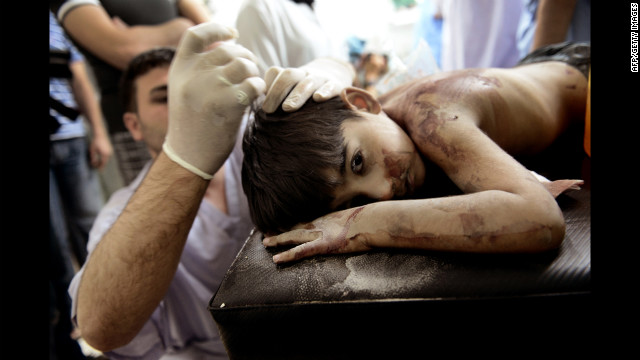 A Syrian boy receives treatment after he was wounded by shells from a government helicopter that hit his house.