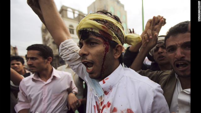 A protester shouts slogans after sustaining injuries from a confrontation with riot police who fired tear gas outside the U.S. Embassy in Sanaa on Thursday.