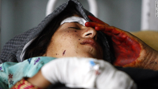 OTAN admite muerte de civiles por un ataque aéreo en Afganistán
