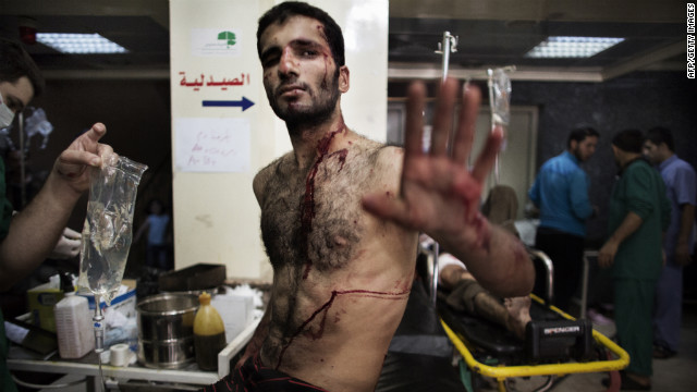 A Syrian rebel gestures as he waits to be treated for his wounds at an Aleppo hospital on Tuesday.