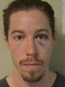 Olympic gold medalist Shaun White, 26, was charged with vandalism and public intoxication in Nashville, Tennessee, on September 16.