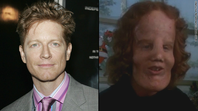 The makeover for Eric Stoltz in 1985's "Mask" was astounding as Stoltz portrayed "Rocky" Dennis, a boy trying to live a normal life with the disorder lionitis. The transformation picked up an Oscar for best makeup.