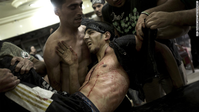 A rebel fighter is carried by his friends and laid on a gurney to be treated for gunshot wounds sustained during heavy battles with government forces in Aleppo on October 1.