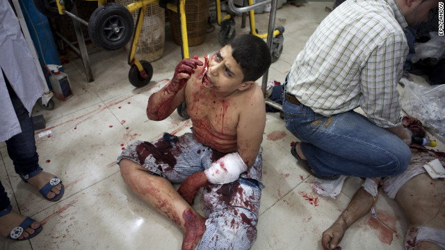 A child covers his wounds from a Syrian army sniper at Dar al Shifa hospital on Thursday.