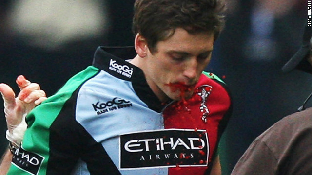 "Bloodgate" rocked English rugby in 2009 when Harlequins' Tom Williams used a fake blood capsule to feign injury and enable an enforced substitution during a cup tie. His replacment almost won the game and Harlequins' director of rugby Dean Richards later trotted out the familiar line that he sanctioned the deceit in the belief that "this was something that was happening on a regular basis at other clubs." He recently ended a three-year ban from the sport. 