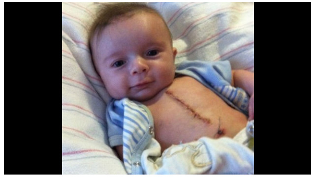 Una foto de Joey Powling le dio el título del bebé más "guapo" del mundo