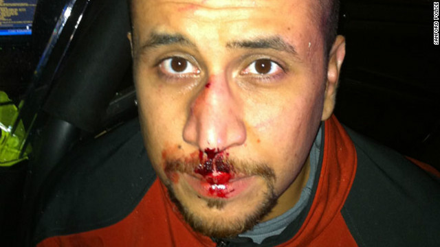 A photo posted online Monday, December 3, shows George Zimmerman with blood on his nose and lips. His attorneys say it was taken the night unarmed teen Trayvon Martin was killed in Sanford, Florida. Zimmerman, 28, faces second-degree murder charges in the death of Martin in Sanford, Florida, on February 26, 2012. Other evidence photos were released earlier this year: 