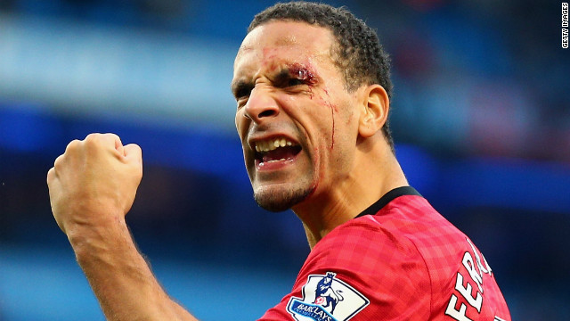 This image of a bloodied and defiant Rio Ferdinand has been at the forefront of a perceived return of hooliganism in English football, following crowd trouble at the Manchester derby. 