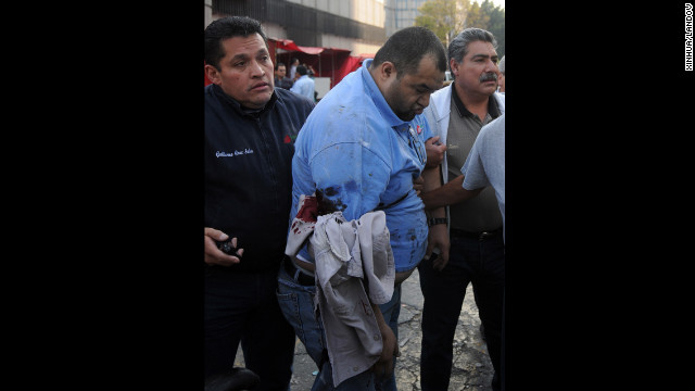 An injured man is helped by others at the site of the blast.