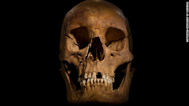 British scientists announced Monday they are convinced "beyond reasonable doubt" that a skeleton found during an archaeological dig in Leicester, central England, last August is that of the former king, who was killed at the Battle of Bosworth Field in 1485. The skull shows a wound to the right cheek. 