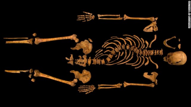 Here, the complete skeleton is laid out, showing the spine's dramatic curve. 