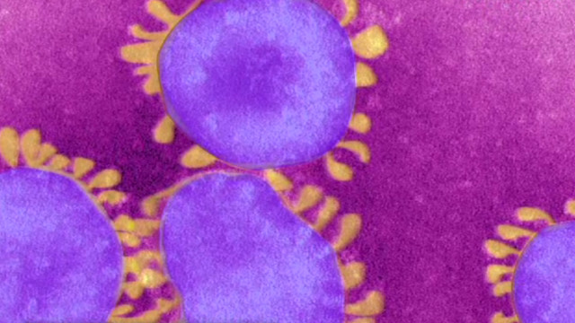 Reportan segundo caso de infección de virus mortal en Francia