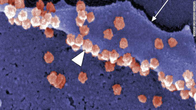 This electron micrograph image from the Centers for Disease Control shows the SARS virus, a "coronavirus" like the common cold, in pink. The virus killed hundreds around the world in 2003. In 2005, the International Health Regulations agreement was proposed. At present, 194 states and territories have signed the agreement that gives the World Health Organization "probing powers" into any signatory country's public health issues. Ten years ago, a plan like this didn't exist.