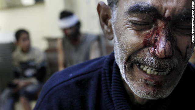A man cries while being treated in a local hospital in a rebel-controlled area of Aleppo on October 31, 2012.