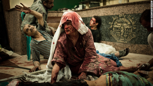 Wounded civilians wait in a field hospital after an air strike on August 21, 2012 in Aleppo.