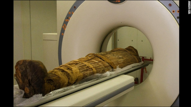 Lessons about disease...from mummies