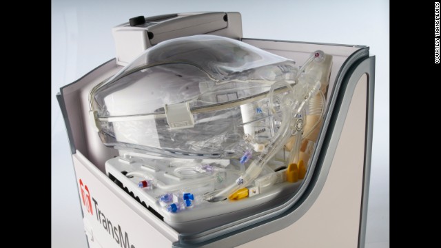 Nueva tecnología de transplante mantiene "vivos" los órganos fuera del cuerpo