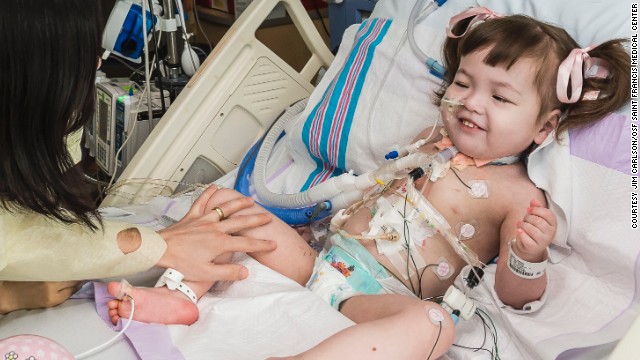Muere la niña que recibió un trasplante experimental en EE.UU.