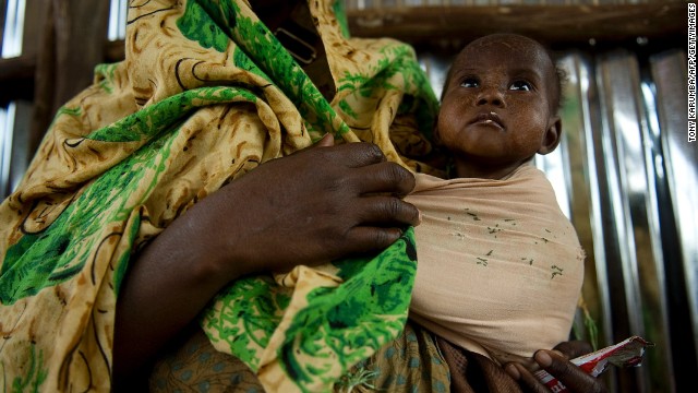 In a file photo, a mother waits with her malnourished child at a feeding center in Dollow, northern Somalia.