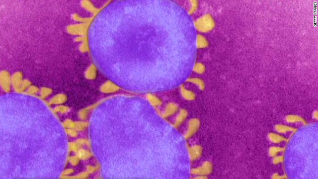 5 cosas que debes saber sobre el nuevo virus parecido al SARS
