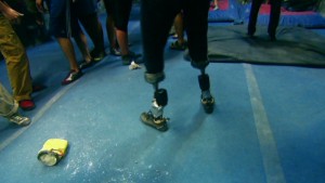 The world's most advanced bionic leg
