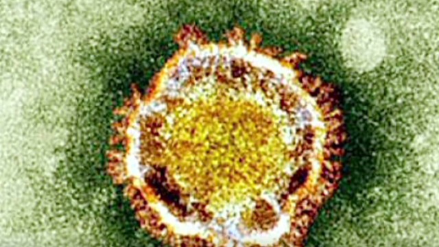 Confirman tres casos de infección del virus mortal MERS-CoV en Italia