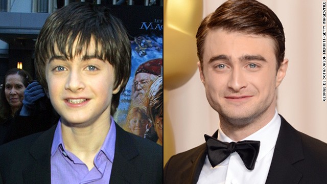 Daniel Radcliffe's development has been watched by millions as he came of age in the "Harry Potter" movie franchise, which launched when he was 12. By 2007, Radcliffe was ready to show how grown-up he'd become and starred in "Equus" in London -- <a href='http://www.huffingtonpost.com/2008/09/26/equus-premieres-on-broadw_n_129505.html' target='_blank'>a stage production that required some nudity. </a>