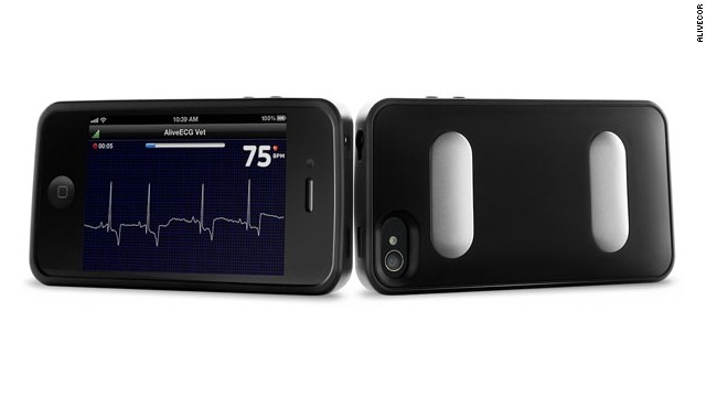 It's an iPhone case and a portable EKG. Users can measure their heart rate by placing their fingers on the metal leads on the back of the case. The monitor is cleared by the Food and Drug Administration for sale to doctors and patients with a prescription.