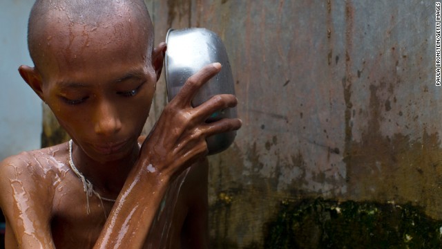 HIV patient, Ma Gyim ,41, bathes herself at the HIV-AIDS Care and Prevention center on April 3, 2012 in Yangon, Myanmar.