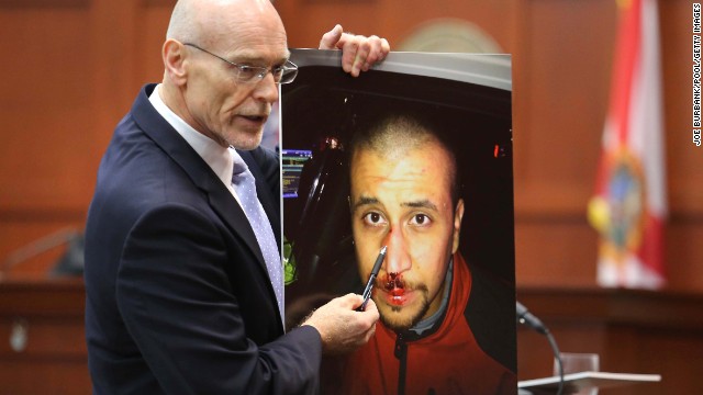 Defense attorney Don West displays a photo of Zimmerman from the night of the shooting during his opening arguments on June 24. He opened his statements with a knock-knock joke but failed to win a laugh. "Knock knock. Who's there? George Zimmerman. George Zimmerman who? Good, you're on the jury," he said.