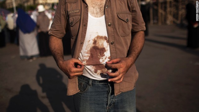 A Morsy supporter shows his bloodied shirt during a July 4 rally near the University of Cairo.