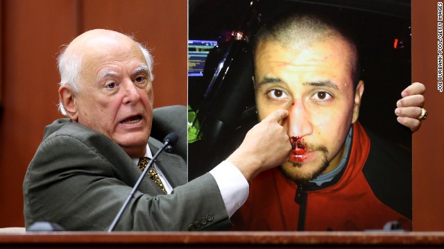 Dr. Vincent Di Maio, a forensic pathologist and gunshot wound expert, describes Zimmerman's injuries while testifying for the defense Tuesday, July 9.