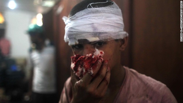 An injured youth is seen at a makeshift hospital in Cairo on August 14.